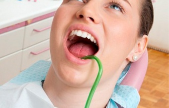 Слюноотсос стоматологический одноразовый со съемным наконечником (зеленый) 100 шт./уп.